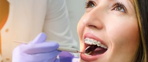 plano odontologico dentista | SulAmérica Odonto PME | Odontoprev PME